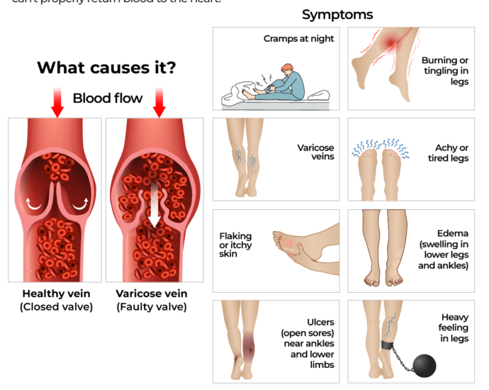 Interactive Chronis Vein Trump 1752831402